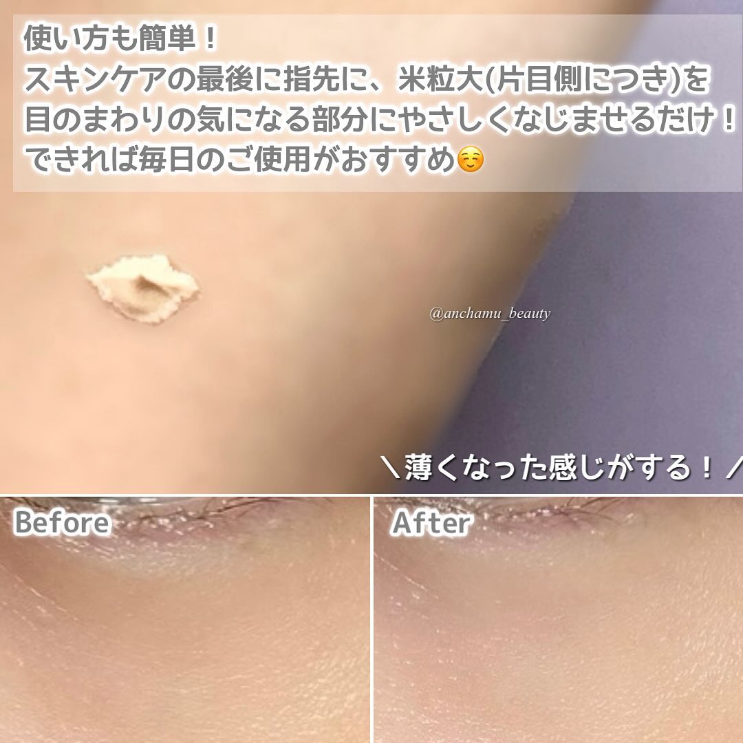 cellcosmetCELLFILLER-XTアイクリーム15ml✴︎使用期限注意 cellcosmetCELLFILLER-XTアイクリーム15ml✴︎使用期限注意